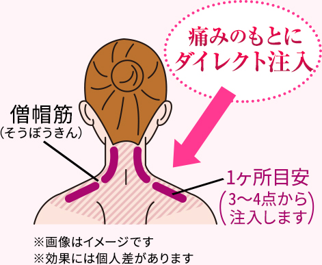 痛みのもとにダイレクト注入