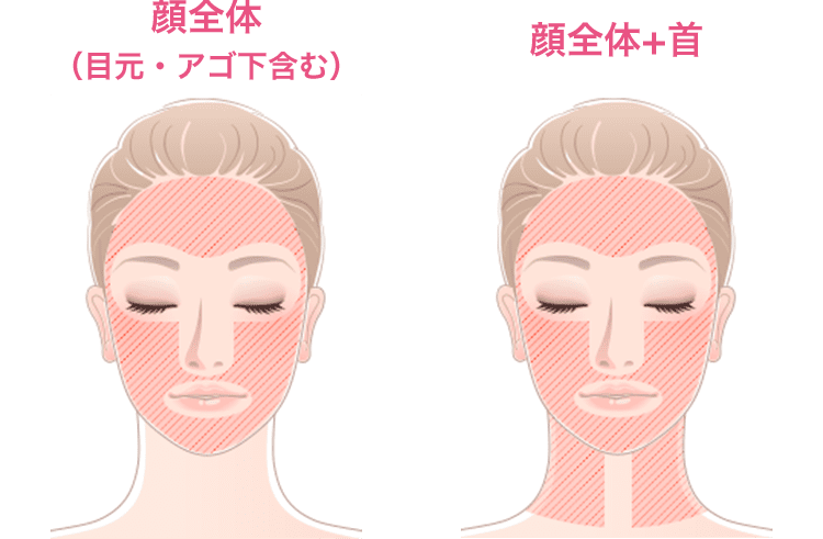 治療箇所