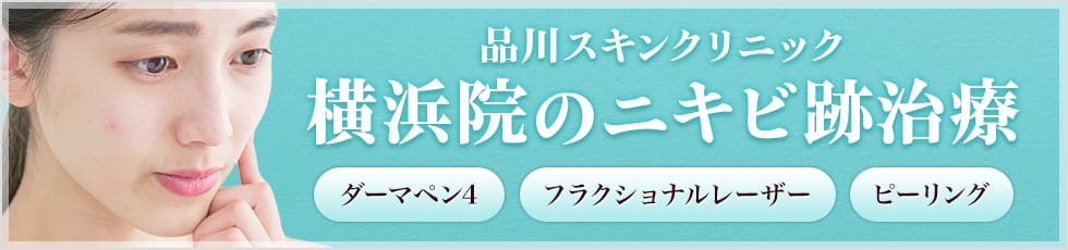 品川スキンクリニック 横浜院のニキビ跡治療 ダーマペン4 フラクショナルレーザー ピーリング