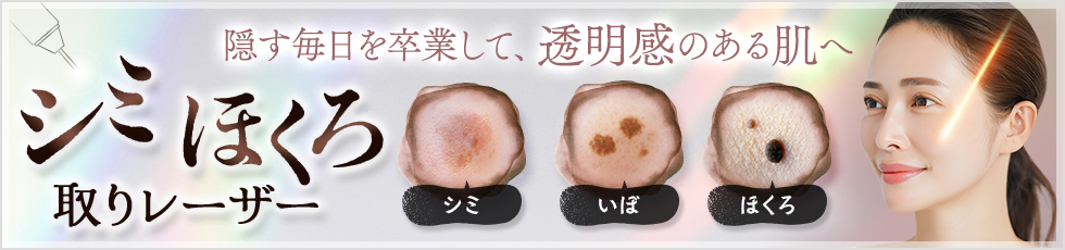 隠す毎日を卒業して、透明感のある肌へ シミほくろ取りレーザー シミ/いぼ/ほくろ