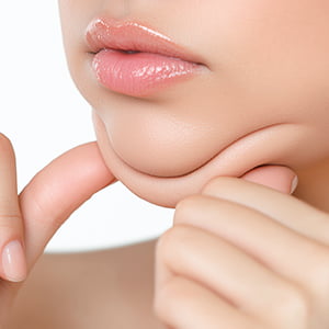 京都院の小顔治療