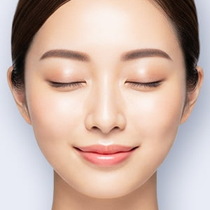 ジュビダームビスタ®ウルトラXC【画像】