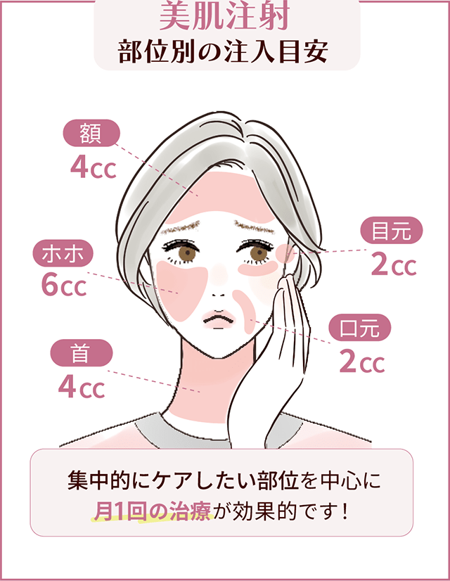 美肌注射 部位別注入の目安 額：4cc ホホ：6cc 首：4cc 目元：2cc 口元：2cc 集中的にケアしたい部位を中心につき1回の治療が効果的です！