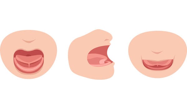 舌の筋肉の衰え【画像】