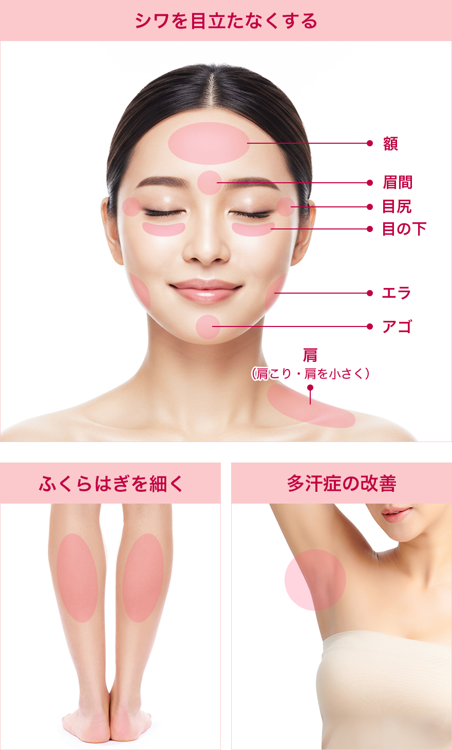 シワを目立たなくする 額 眉間 目尻 目の下 エラ アゴ 肩（肩こり・肩を小さく） ふくらはぎを細く 多汗症の改善