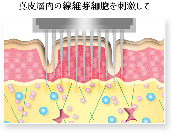 真皮層内の線維芽細胞を刺激して