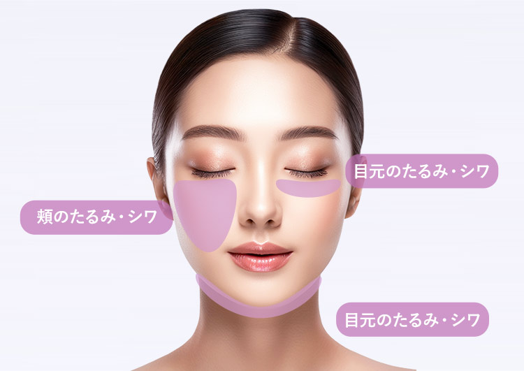 即日実感！ハイフ 3D HIFU 引き締め×美肌 W効果 小顔・ハリツヤ・たるみ・毛穴【画像】