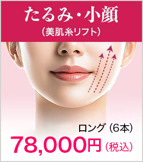 たるみ・小顔（美肌糸リフト）【画像】