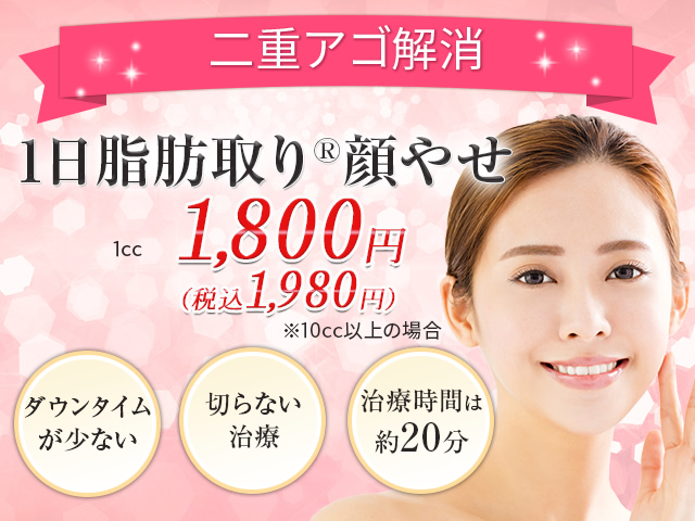 1日脂肪取り顔やせ