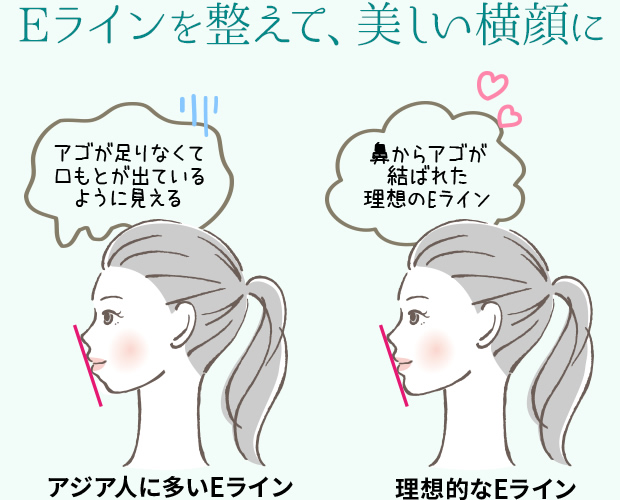Eラインを整えて、美しい横顔に