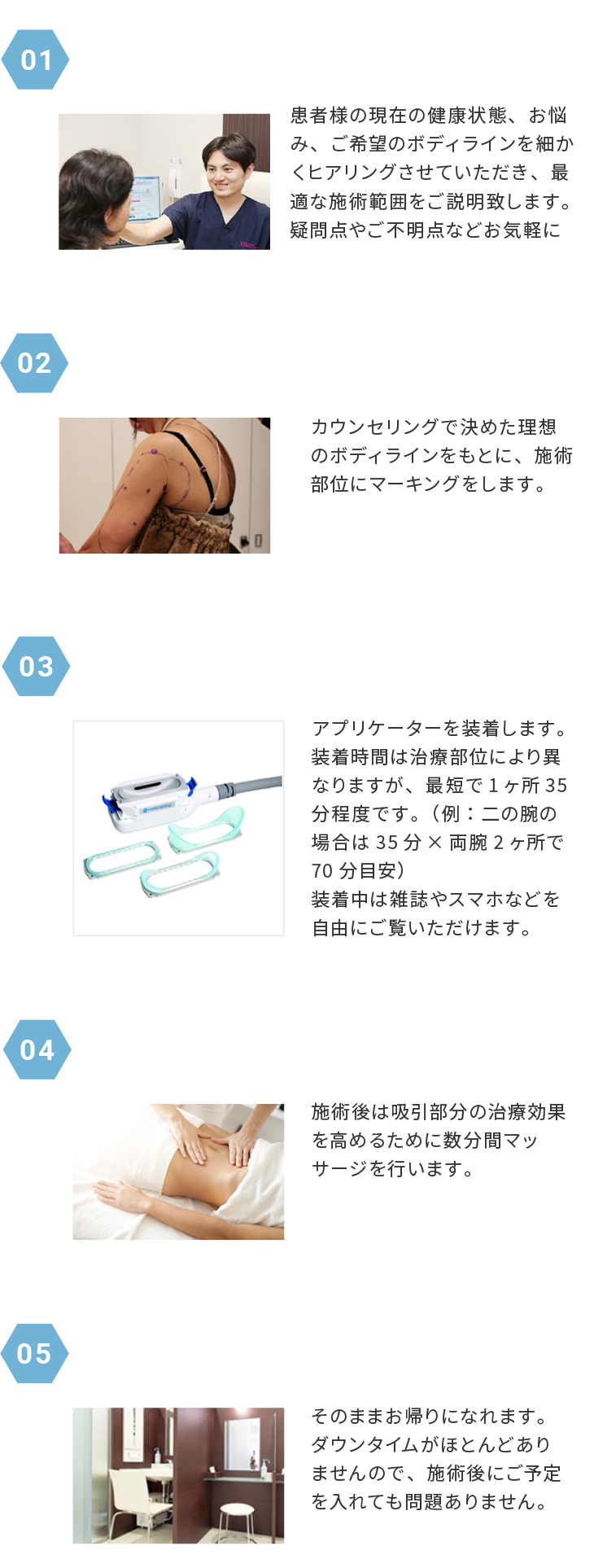 施術の流れ
