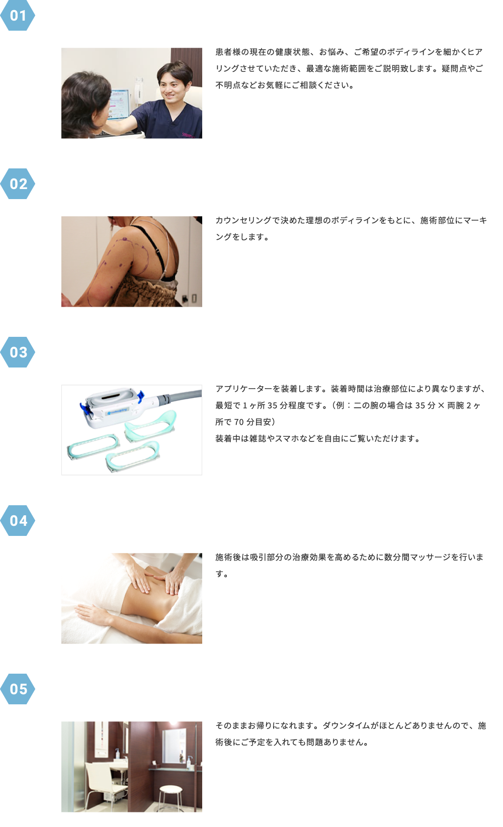 施術の流れ