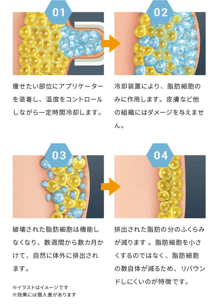 脂肪減少の仕組み