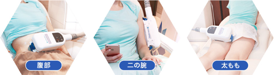 二の腕 太もも おなか 脂肪吸引