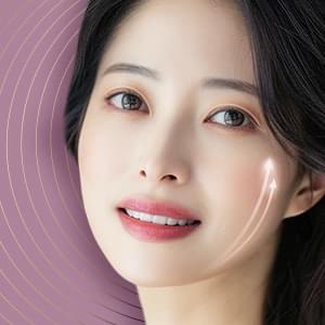 糸リフト（美肌糸リフト）
