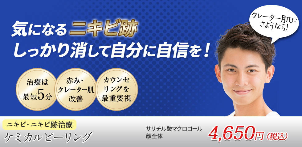 美容皮膚科のニキビ跡治療で長年のお悩みを解消！