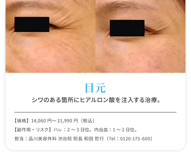 目元