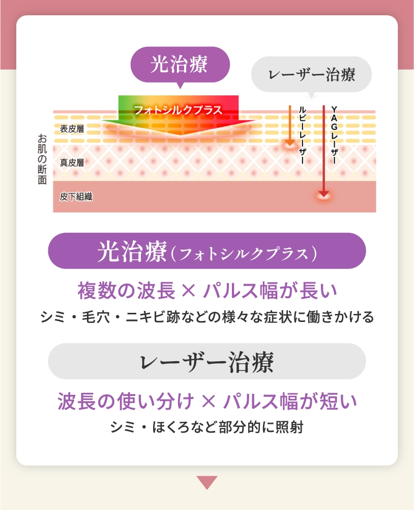 光治療（フォトシルクプラス）とレーザー治療の違いは？