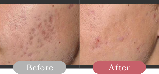 症例写真 Before After 04