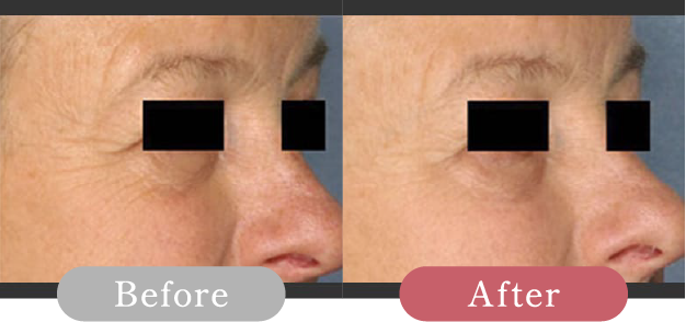 症例写真 Before After 05