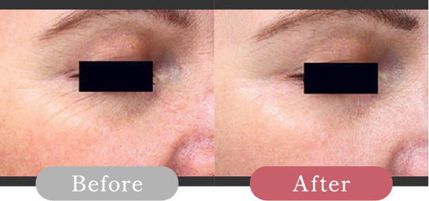 症例写真 Before After 05