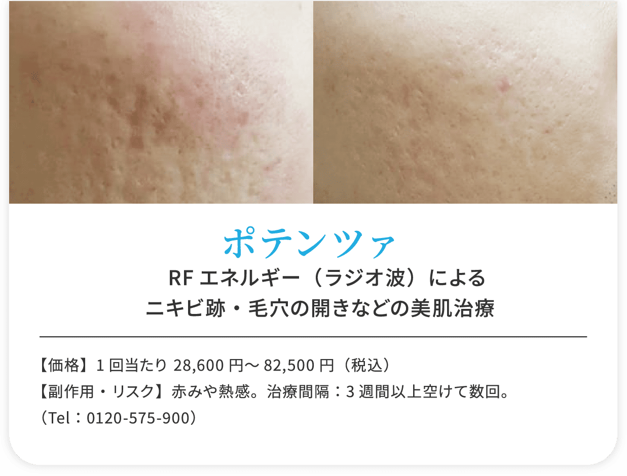 ポテンツァ