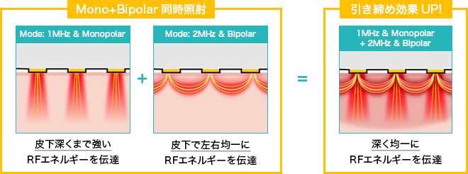 ダイヤモンドチップの説明