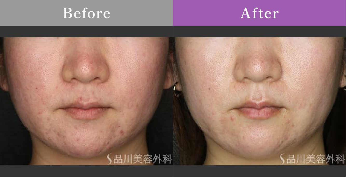 症例写真 Before After 01