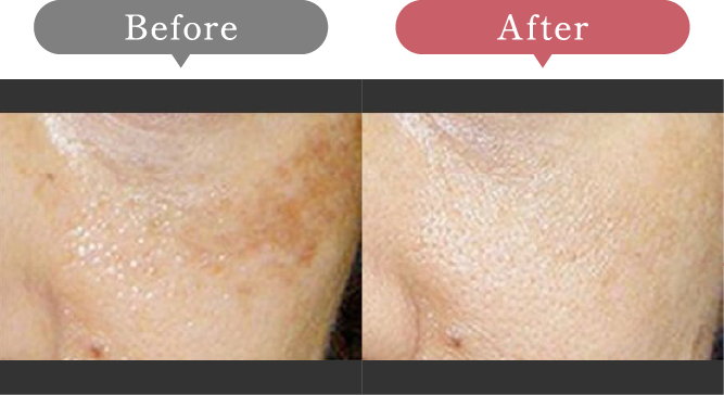 症例写真 Before After 05