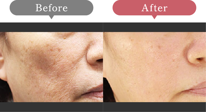 症例写真 Before After 05