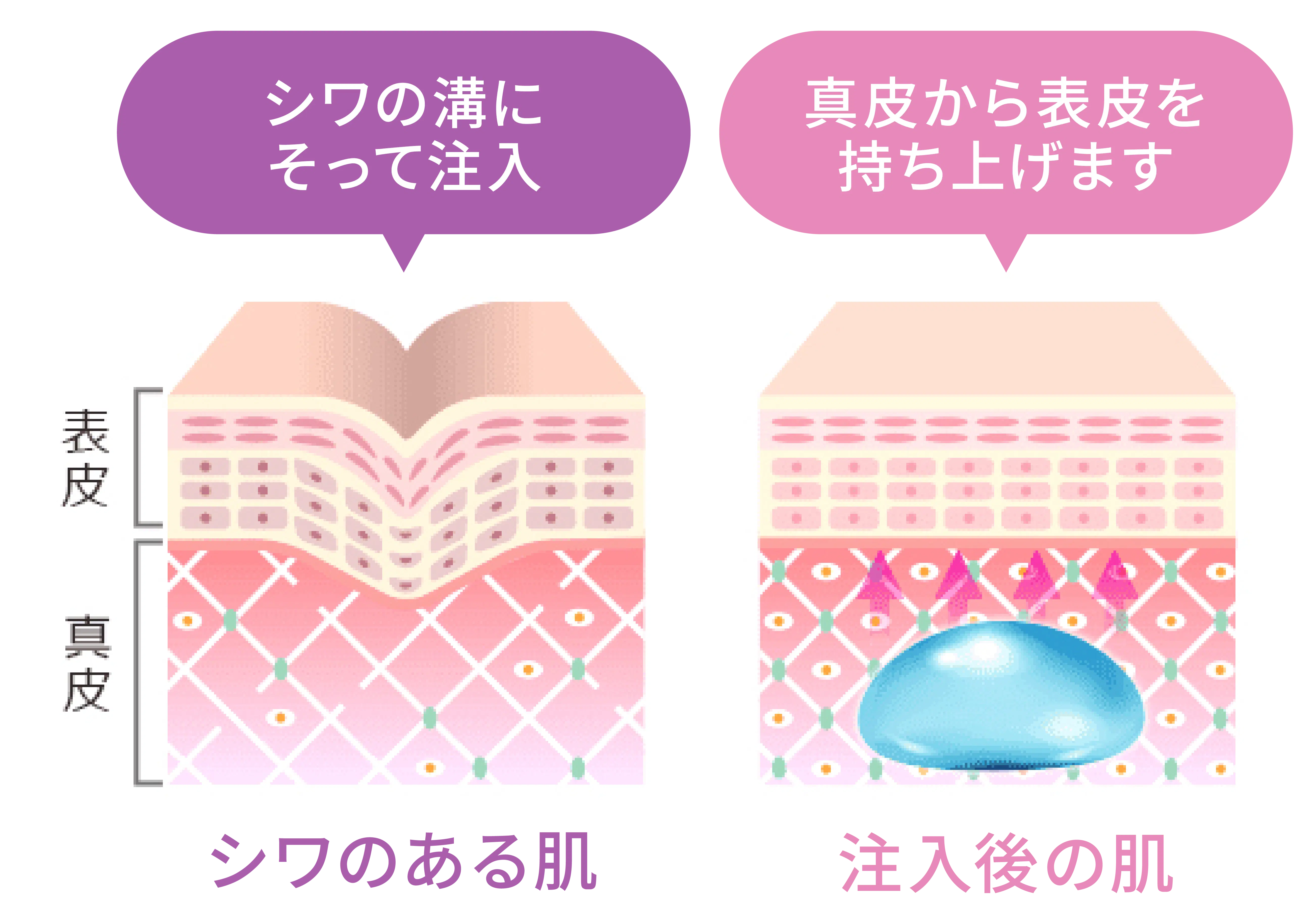 ダイレクト注入だから即実感！