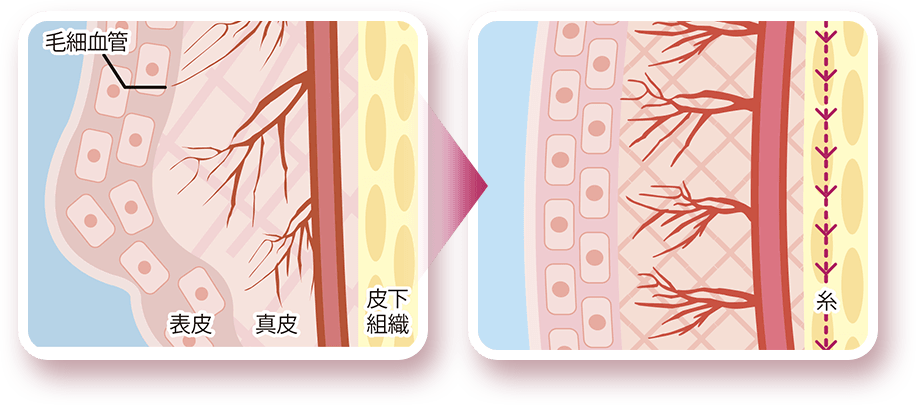 強力リフトアップ×美肌効果