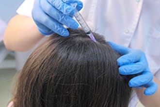 頭皮に注射【画像】