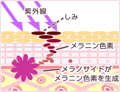 紫外線 しみ メラニン色素 メラノサイトがメラニン色素を生成【画像】