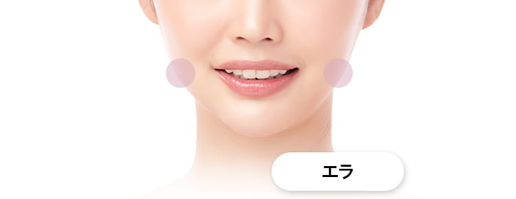 【アラガン社ボツリヌス注射】プチ小顔処置部位：エラ【画像】