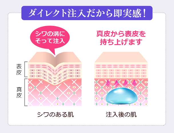 ヒアルロン酸画像