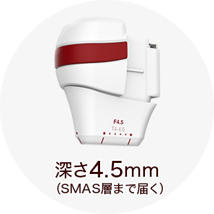 深さ4.5mm（SMAS層まで届く）