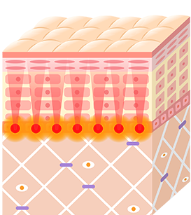 リフティング＆引き締め