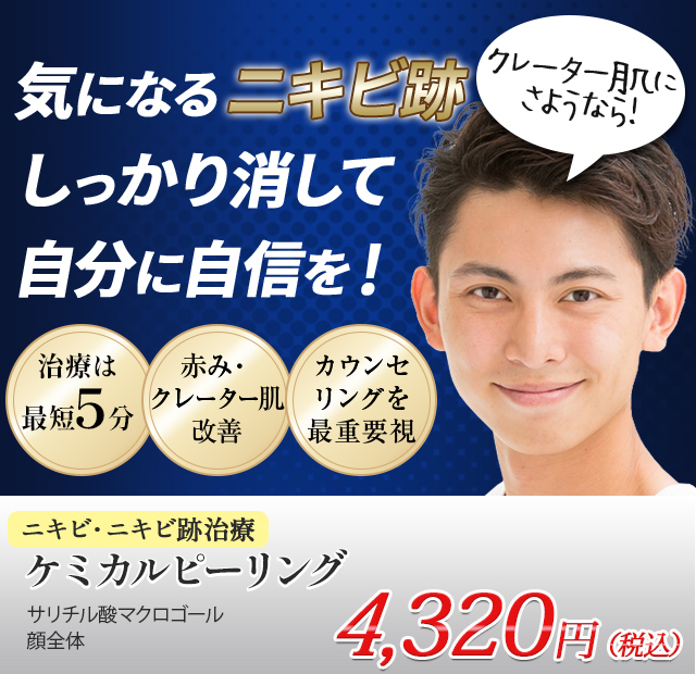 美容皮膚科のニキビ後治療で長年のお悩みを解消！