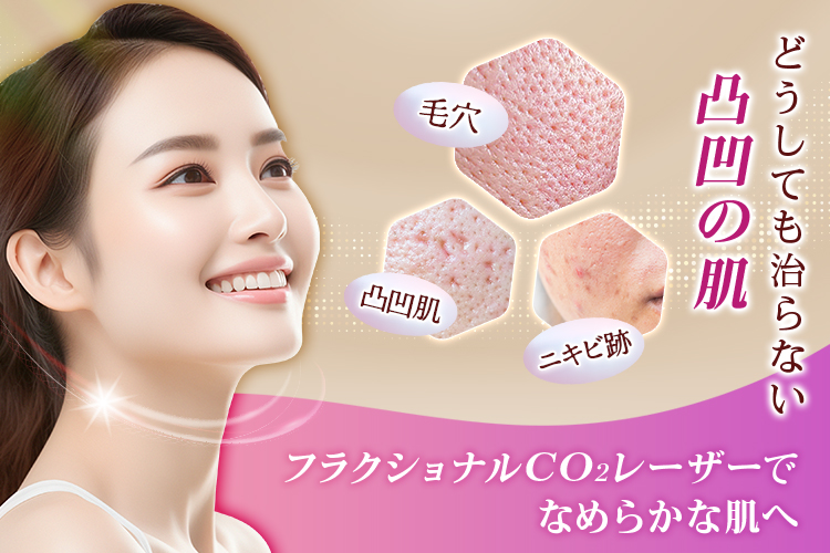 毛穴・凸凹肌・ニキビ跡 どうしても治らない凸凹の肌 フラクショナルCO2レーザーでなめらかな肌へ