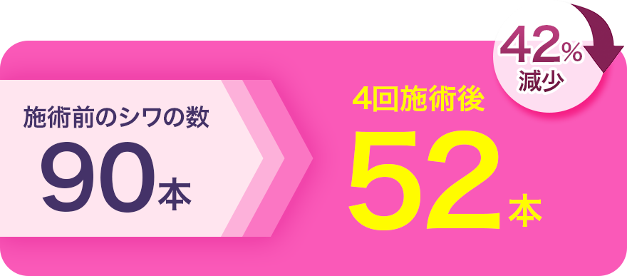 施術前のシワの数90本 4回施術後52本 42%減少