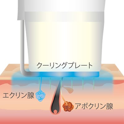 特許技術のクーリングプレート【画像】