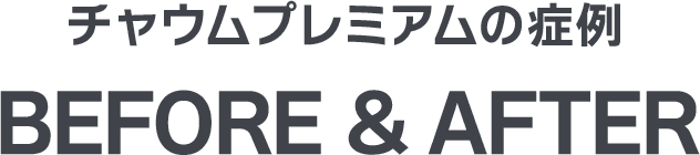 チャウムプレミアムの症例 施術前と施術後