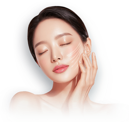 美肌糸リフト