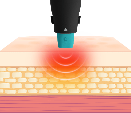 Gモード
