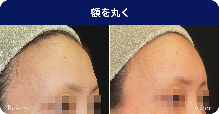 額を丸く【画像】