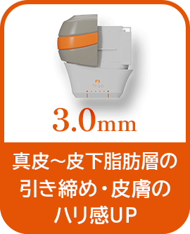3.0mm 真皮～皮下脂肪層の引き締め・皮膚のハリ感アップ