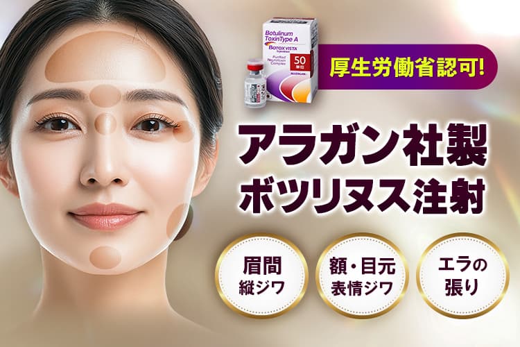 厚生労働省認可!アラガン社製ボツリヌス注射 眉間縦ジワ/額・目元表情ジワ/エラの張り