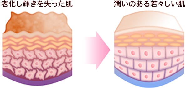 老化し輝きを失った肌 潤いのある若々しい肌【画像】