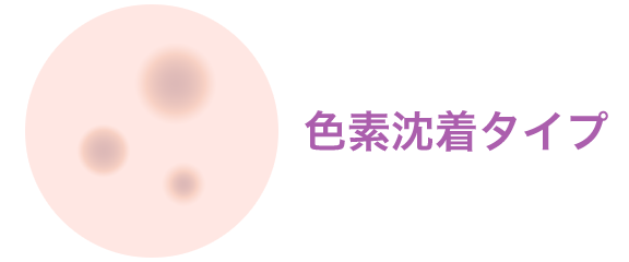 色素沈着タイプ【画像】